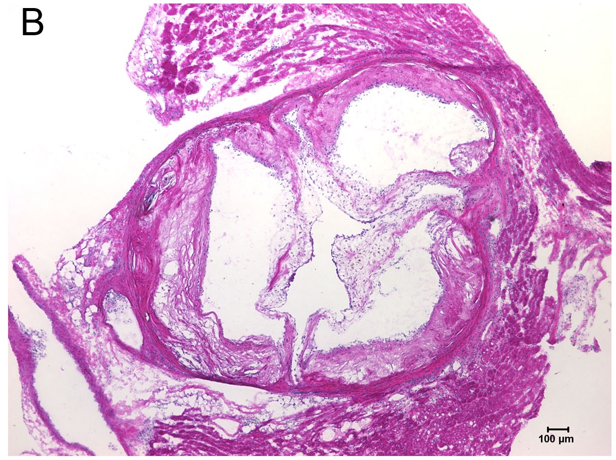 Hematoxylin and Eosin