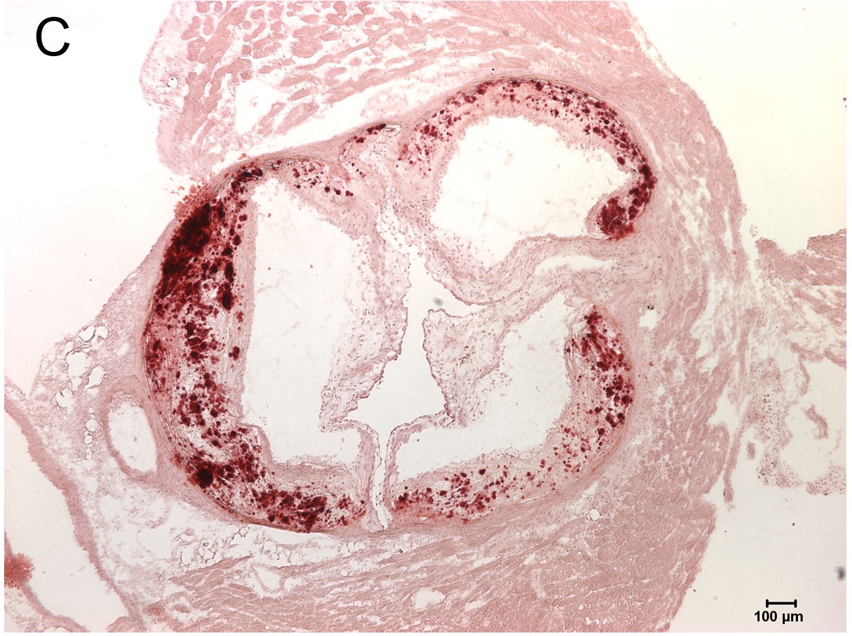 Alizarin Red Stain for Calcification