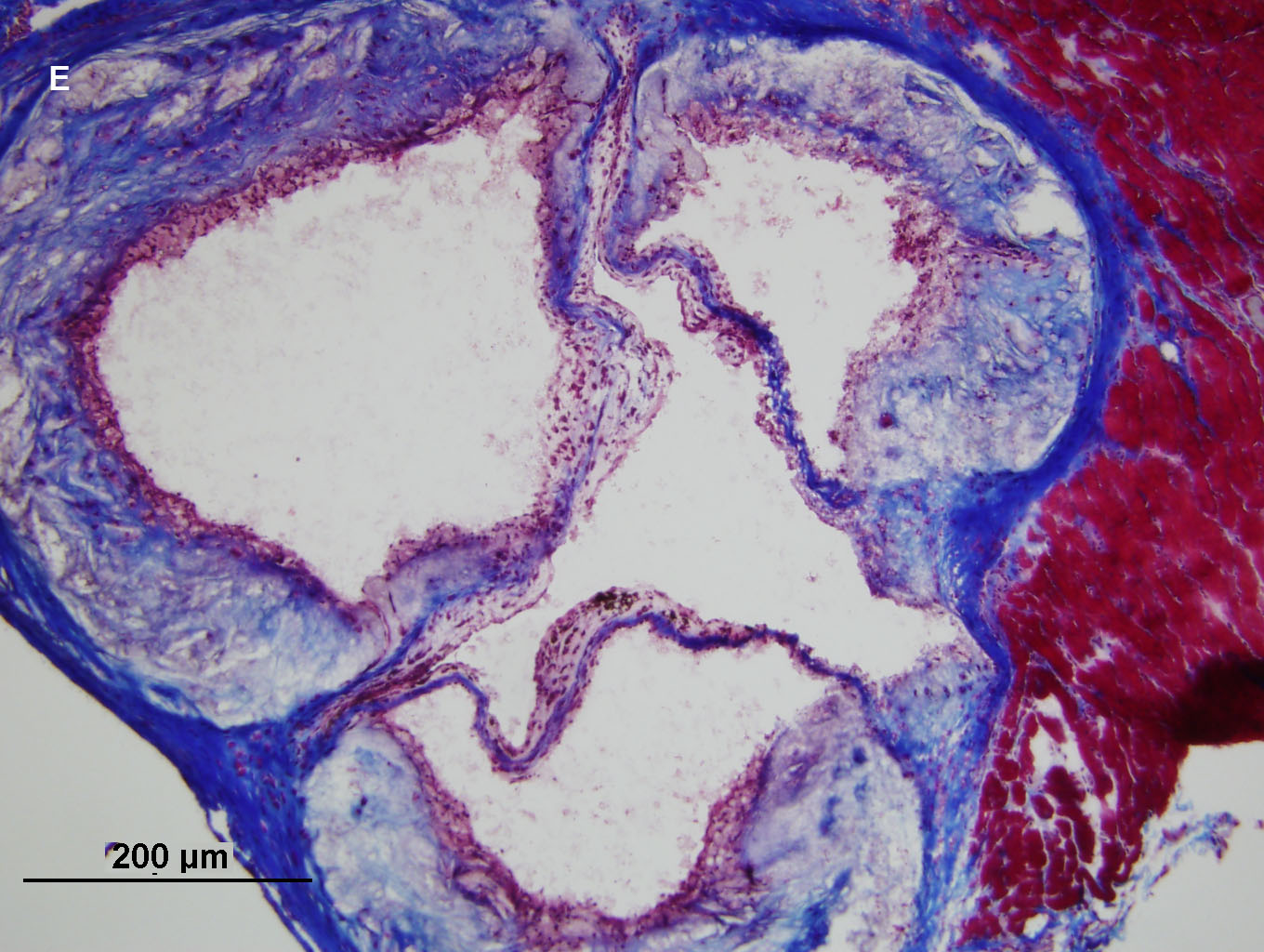 Masson's Trichrome