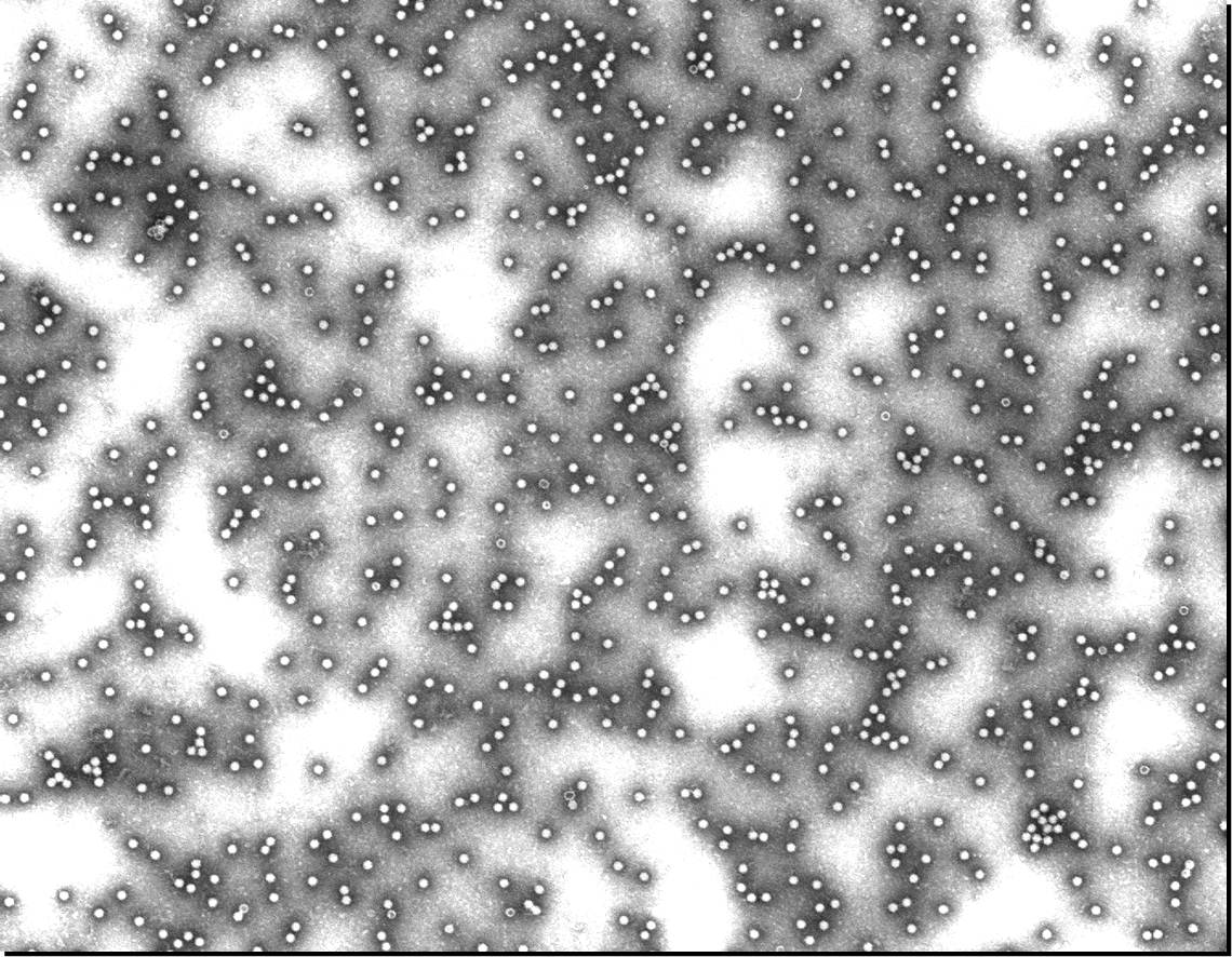 Adeno-Associated Virus (TEM)