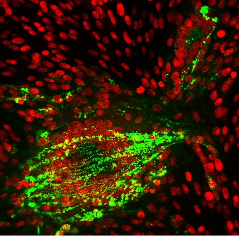 Chicken Pox Virus Image by- Chuck Grose