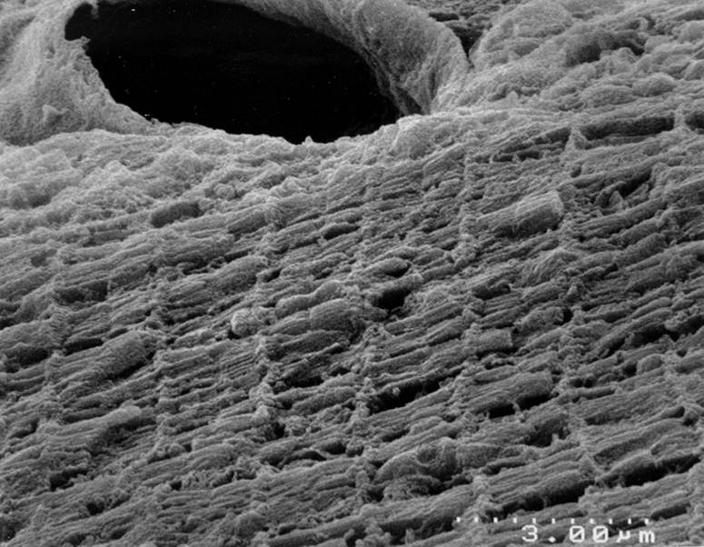 Cryo-Fractured Heart Muscle (SEM)