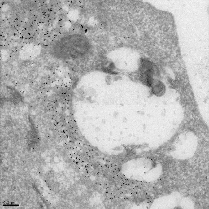 Cryoultrathin Section-Vero E6 Cells were Infected with rSARS-CoV-Δ6, p6-GFP Labeled with 10nm Gold (6-GFP-1h-0037) (TEM)