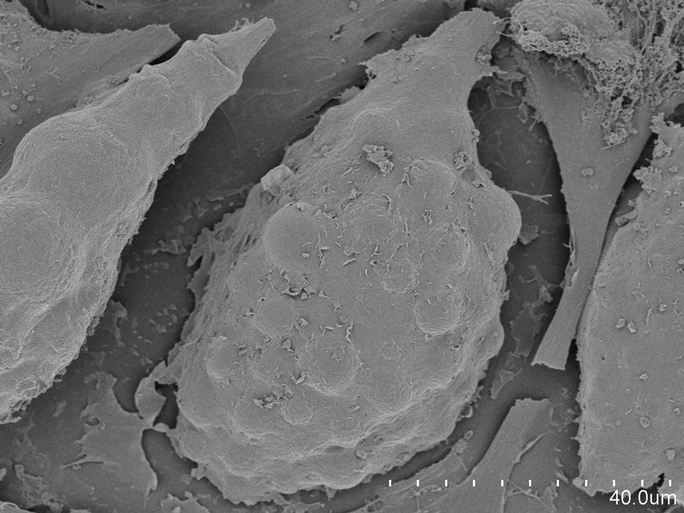 Fat Cells (SEM)