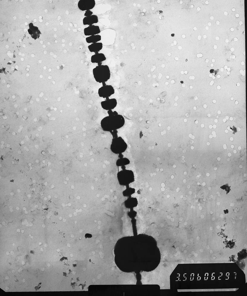 Fat Cells (TEM)