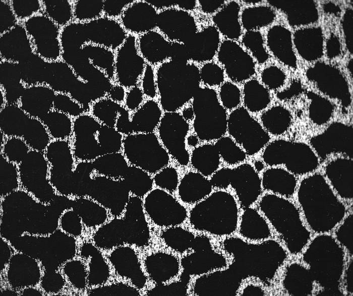 Fused Canine Vertebrae-Calcium X-Ray Dot Map (SEM)