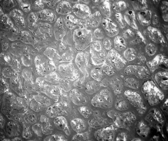 Fused Canine Vertebrae-Secondary Electron Image (SEM)
