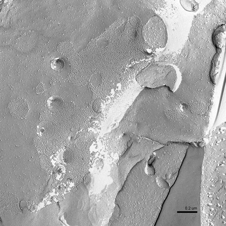 Gap Junctions-Freeze Fracture Replica (TEM)