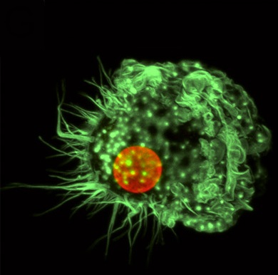 Human Dendritic Cell Image by- Karla Daniels