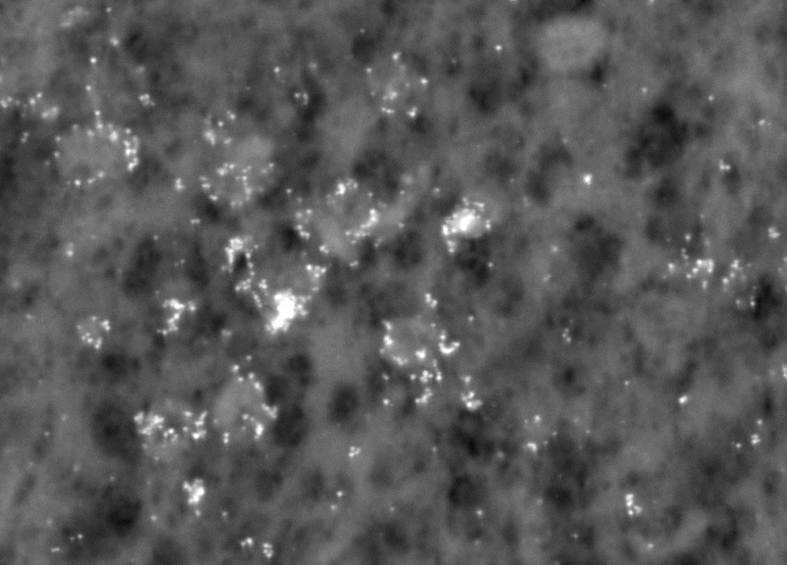 Immungold Labeled Virus in Fibroblast Culture-Backscattered Electron Image (SEM)