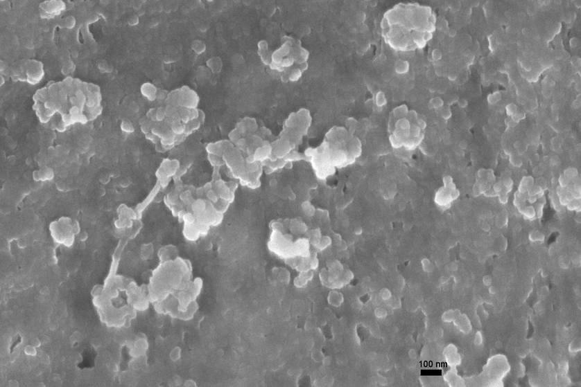 Immungold Labeled Virus in Fibroblast Culture-Secondary Electron Image (SEM)