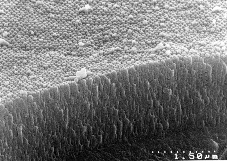 Intestine (SEM)