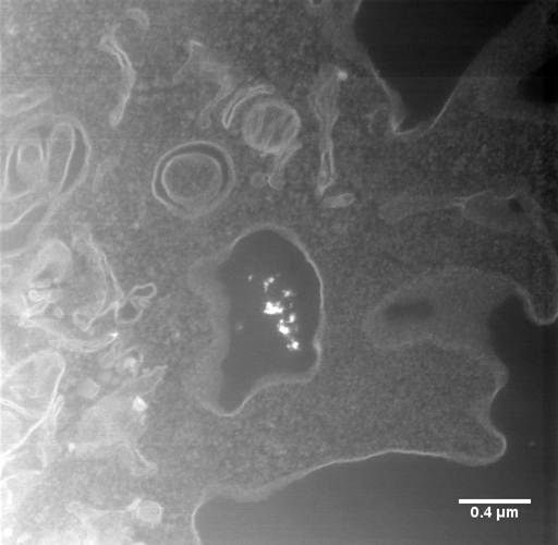 Iron Oxide in Macrophage
