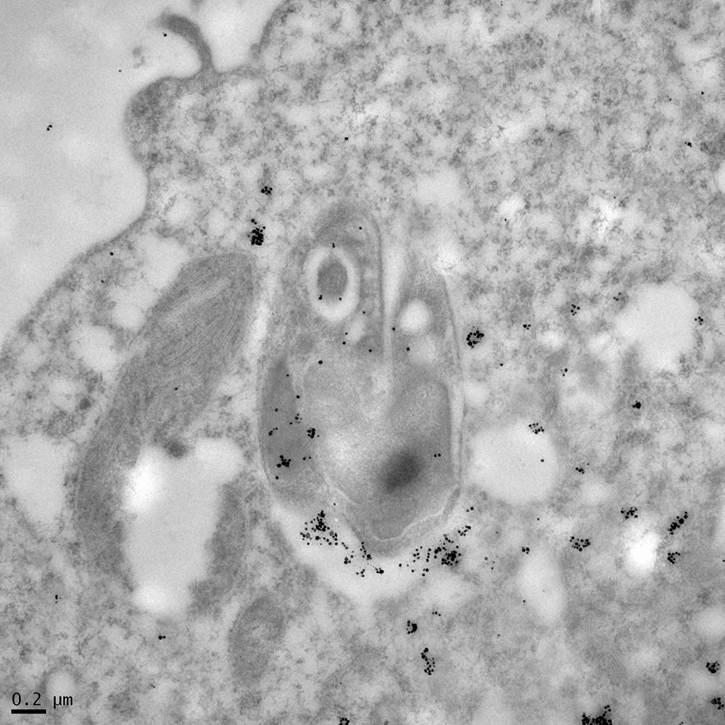 Leishmania Protease GP63 Immunogold Labeling in Human Macrophage (TEM)