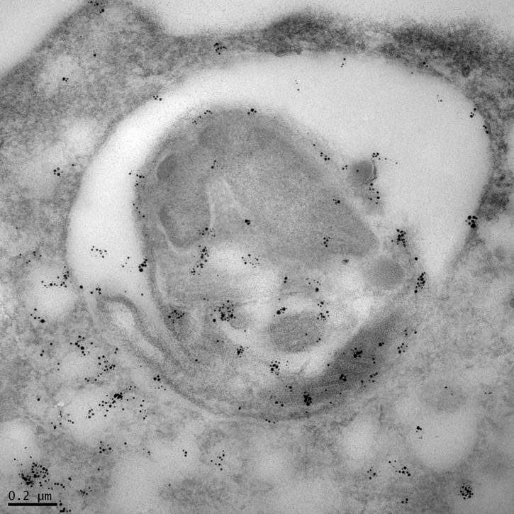 Leishmania Protease GP63 Immunogold Labeling in Human Macrophage (TEM)