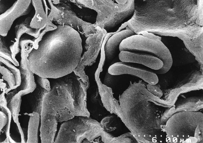 Lung (SEM)