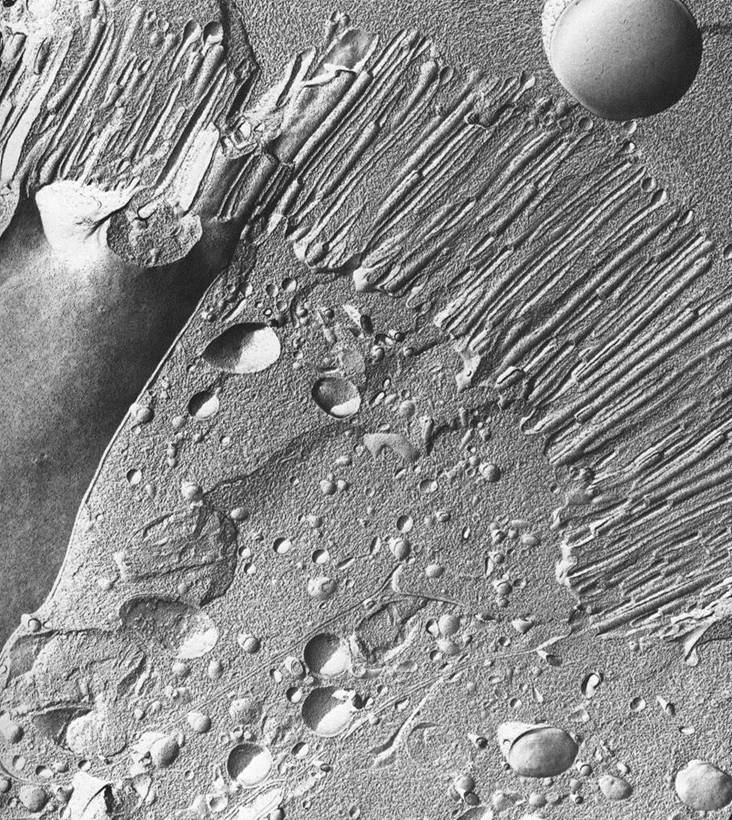 Microvilli-Freeze Fracture Replica (TEM)