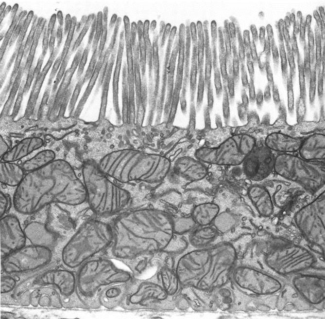 Microvilli-Thin Section (TEM)