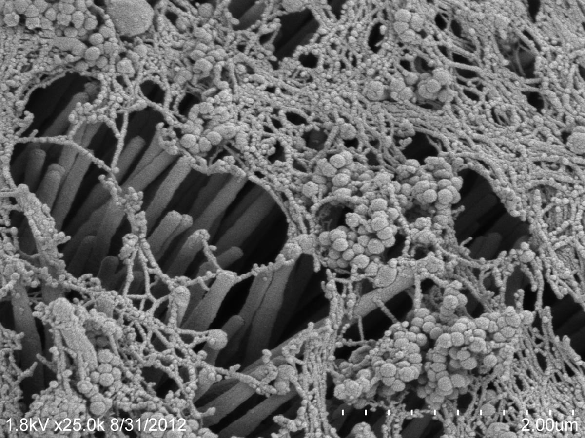 Mucus on Pig Trachea Image by- Michael Welsh & Tom Moninger