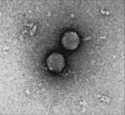 Negative Stained Virus (TEM)