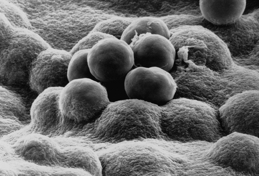 Neisseria Meningitidis