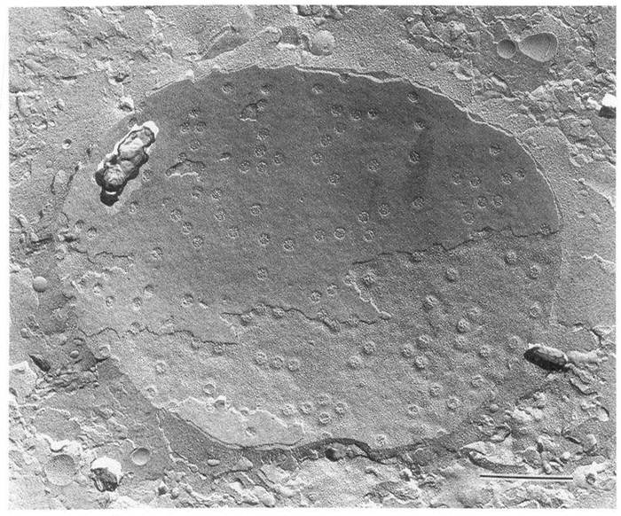 Nuclear Pores-Freeze Fractue Replica (TEM)