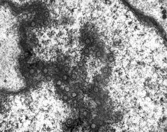 Nuclear Pores-Thin Section (TEM)