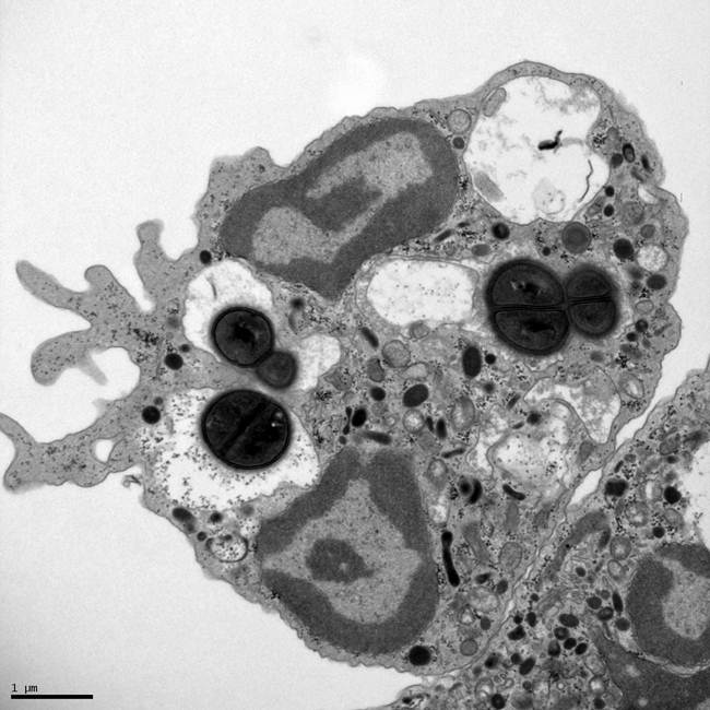 PMN Infeted with F. Tulerensis (TEM)