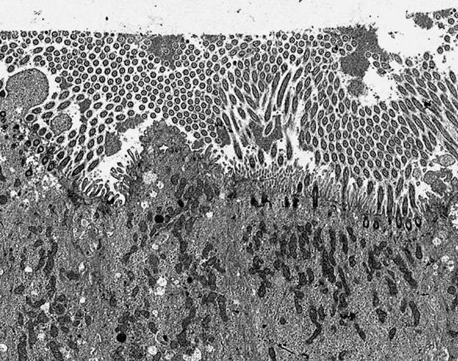 Perfluorocarbon-OsO4 Fixation for Bio-Films-Primary Airway Culture (TEM)
