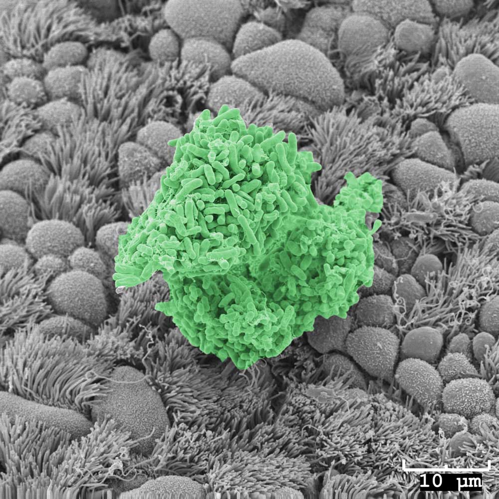 Pseudomonas Aeruginosa Biofilm on Mouse Trachea