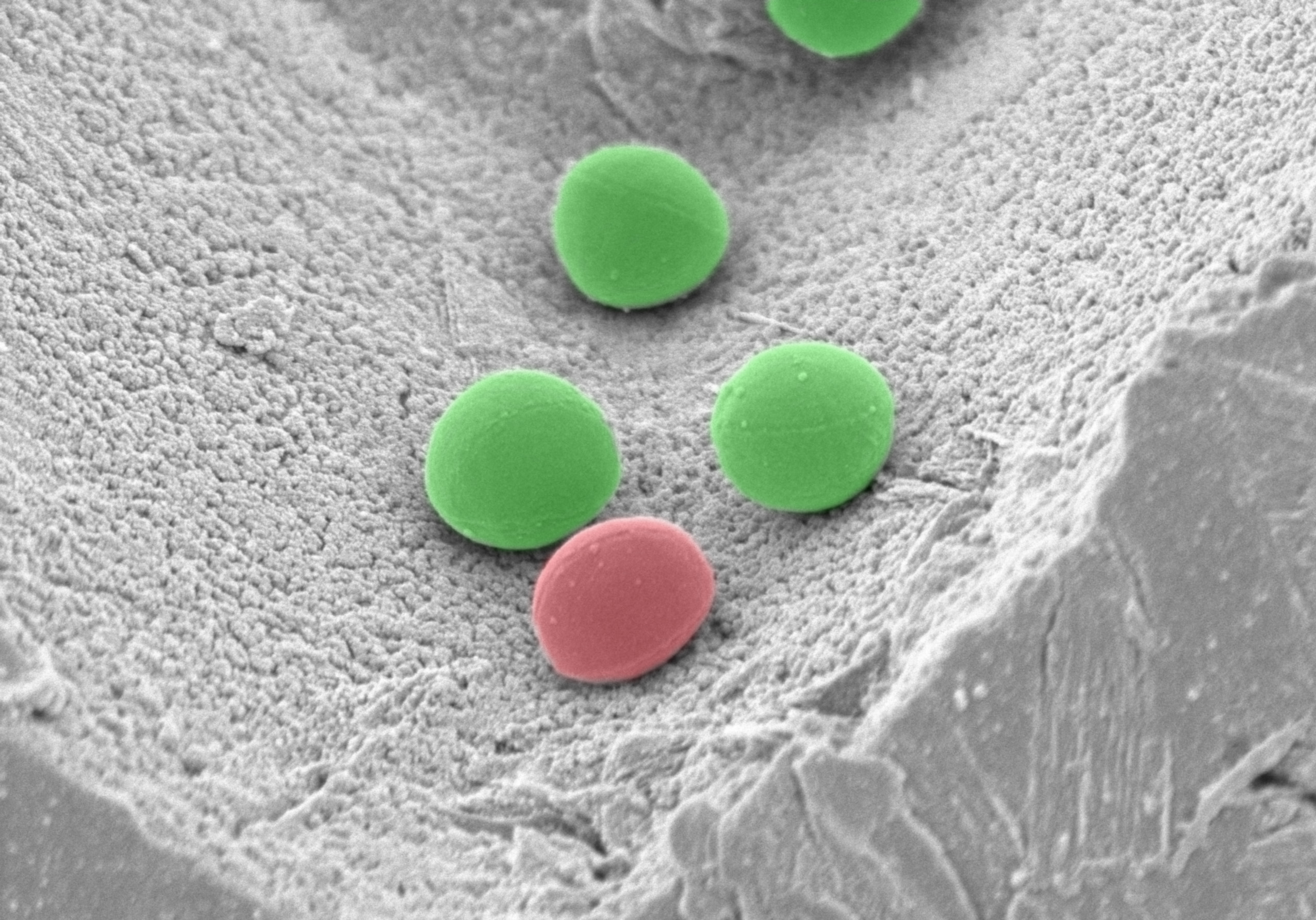 Staphylococcus Aureus Image by- Michael Welsh & Tom Moninger