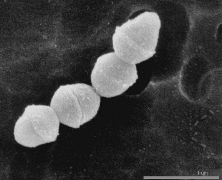 Strep A (SEM)