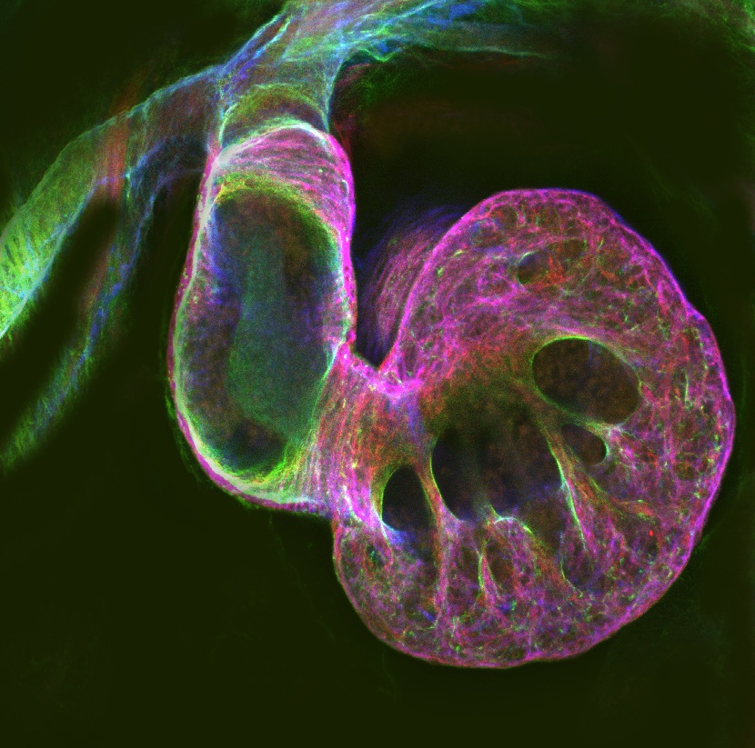Tadpole Heart