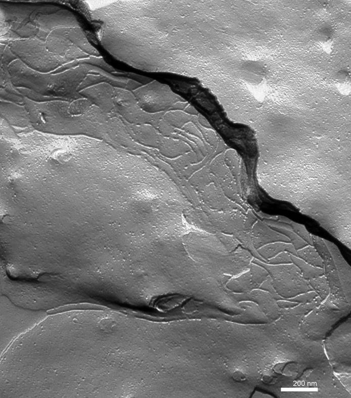 Tight Junctions-Freeze Fracture Replica (TEM)