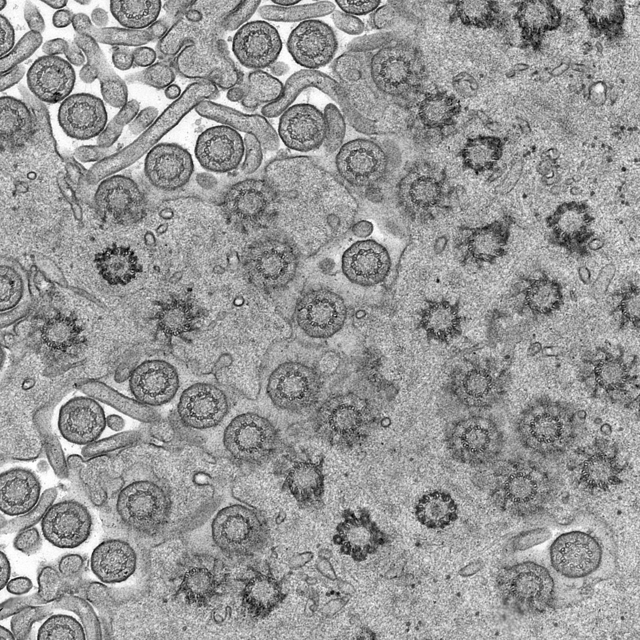 human cilia and basal bodies