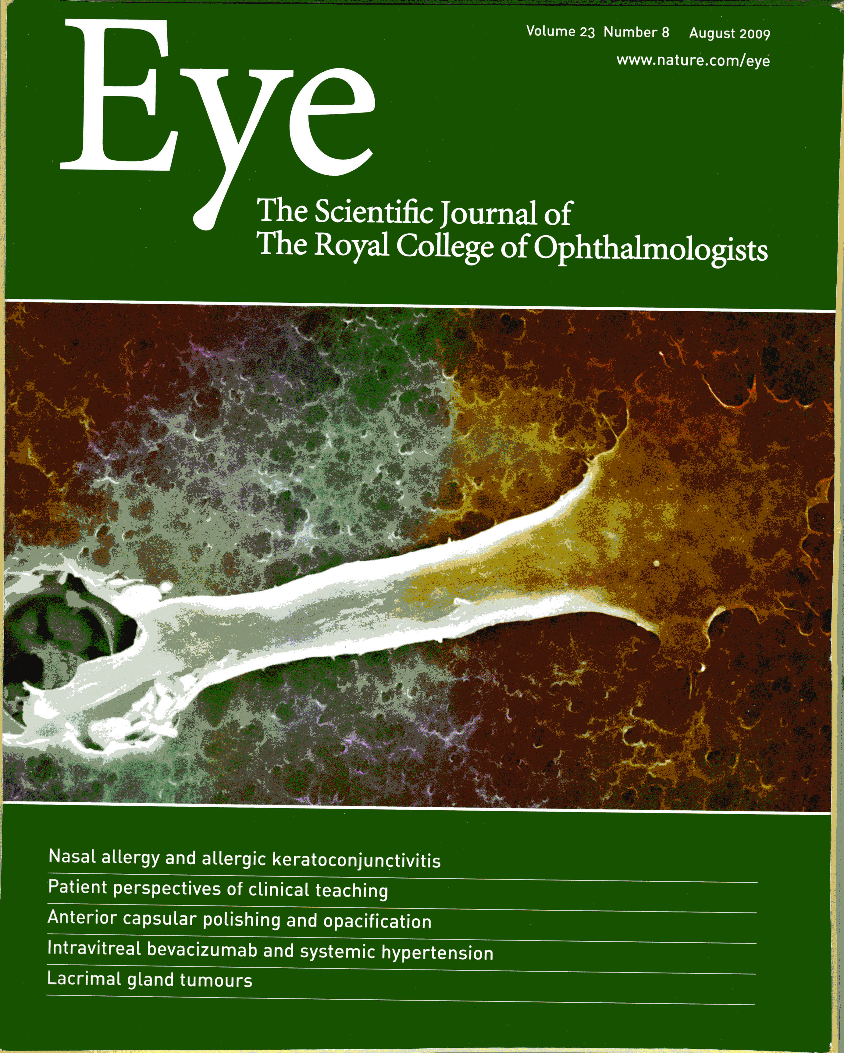 EYE: The Scientific Journal of The Royal College of Ophthamologists