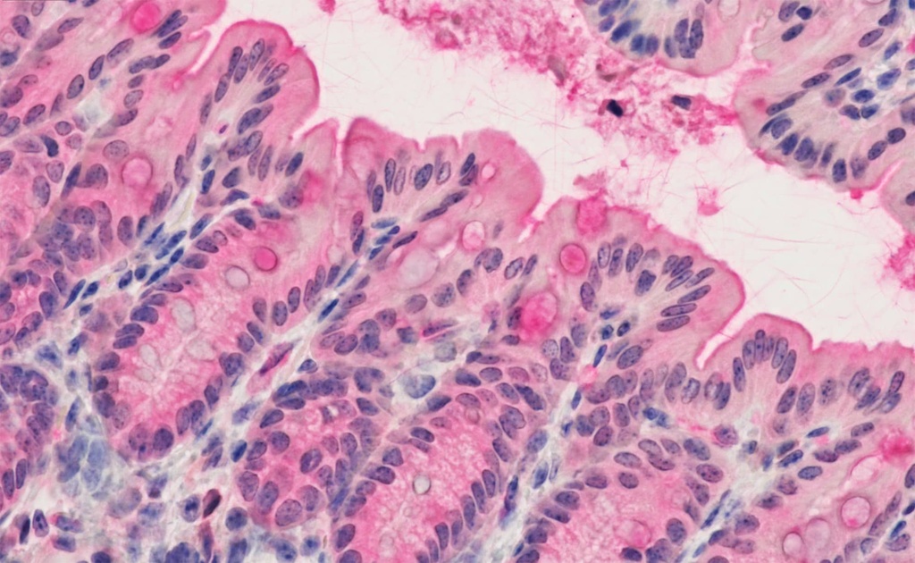 Immunohistochemistry of mouse colon